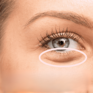 EyeGlow Rejuvenating Red Light Therapy | Strålande ögonområde och mindre rynkor och fina linjer